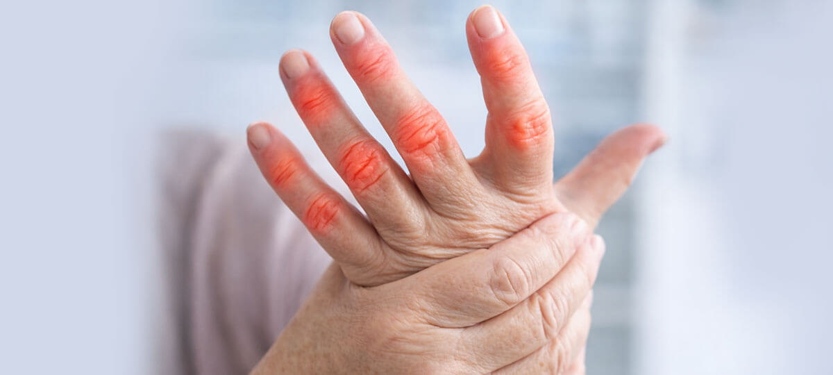 Rheumatological Conditions Treatment